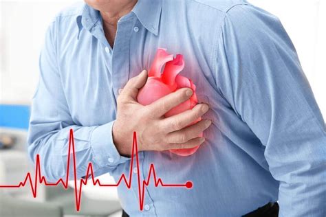 Penyakit Jantung Aritmia: Mengenal dan Mengatasi Gangguan Irregularitas Jantung